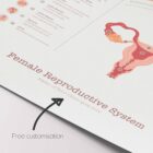 Female Reproductive System anatomy chart for clinics