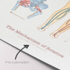 Mechanism of Sciatica anatomy chart for clinics