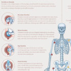 Bursitis, Arthritis and Tendonitis anatomy chart for clinics