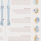 Bursitis, Arthritis and Tendonitis anatomy chart for clinics