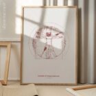 Vitruvian Amputee anatomy chart for clinics