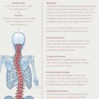 Scoliosis and Musculoskeletal Disorders anatomy chart for clinics