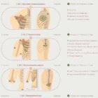 Amputations and Prosthetic Pressure Distribution anatomy chart for clinics