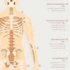 Amputations and Prosthetic Pressure Distribution anatomy chart for clinics