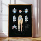 Mechanism of Sciatica anatomy chart for clinics