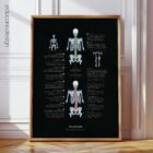 Scoliosis and Musculoskeletal Disorders anatomy chart for clinics