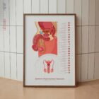 Système Reproducteur Masculin planche anatomique pour cabinets et cliniques