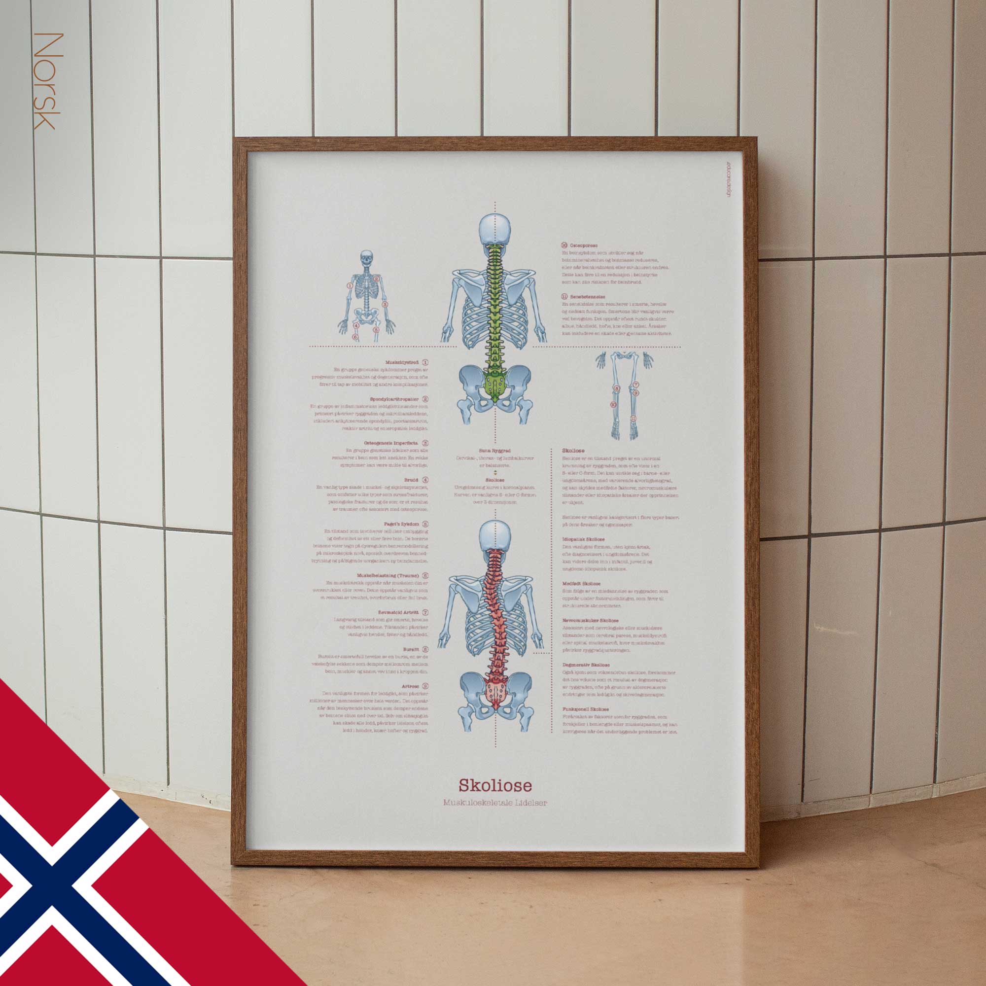 Scoliosis and Musculoskeletal Disorders