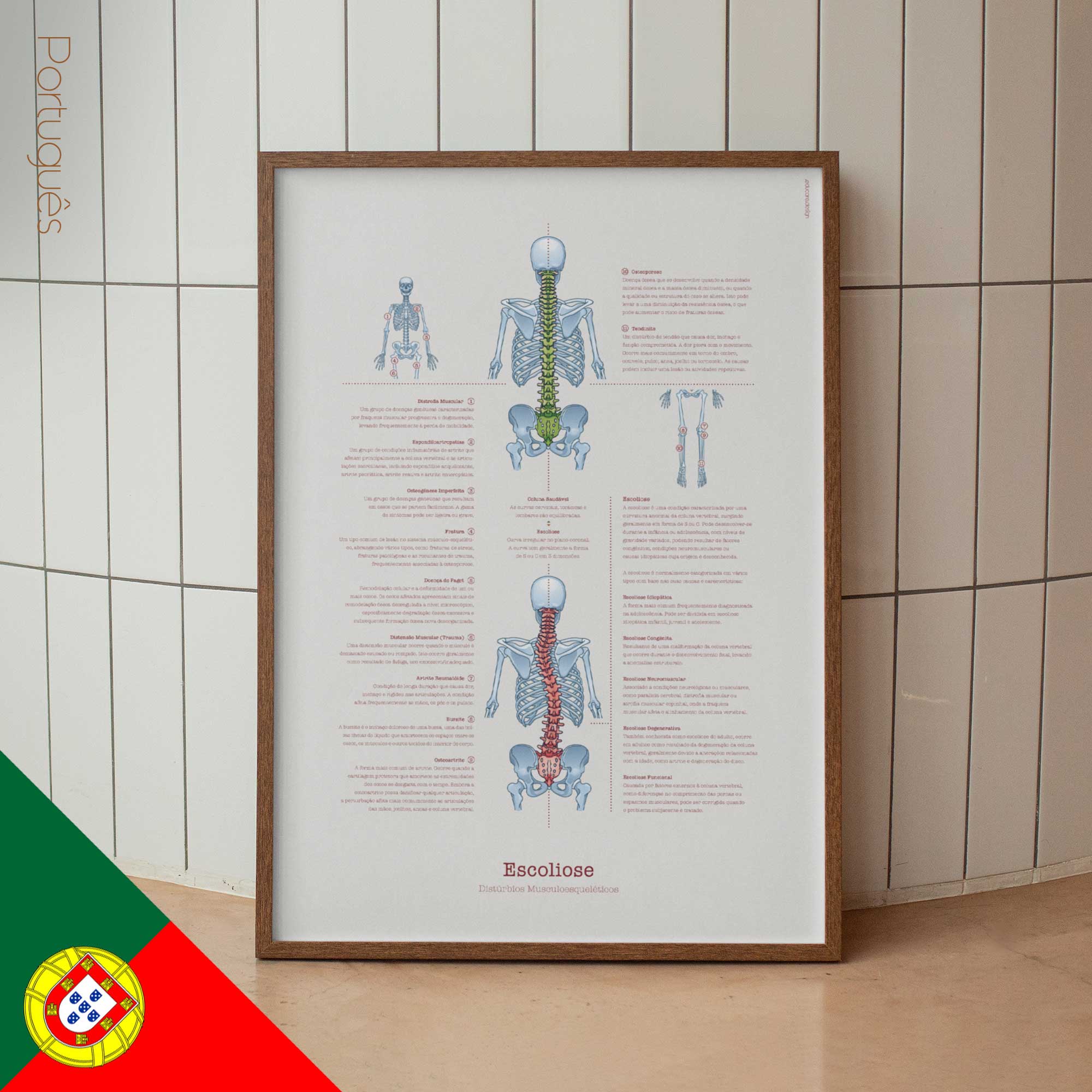 Scoliosis and Musculoskeletal Disorders