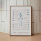 Bursitis, Arthritis und Tendinitis Anatomie-Chart für Praxen und Kliniken