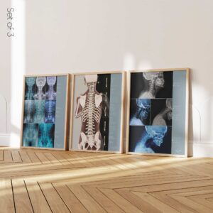 Posture Set on sale