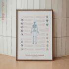 Bursitis, Artritis y Tendinitis lámina anatómica para clínicas y consultas