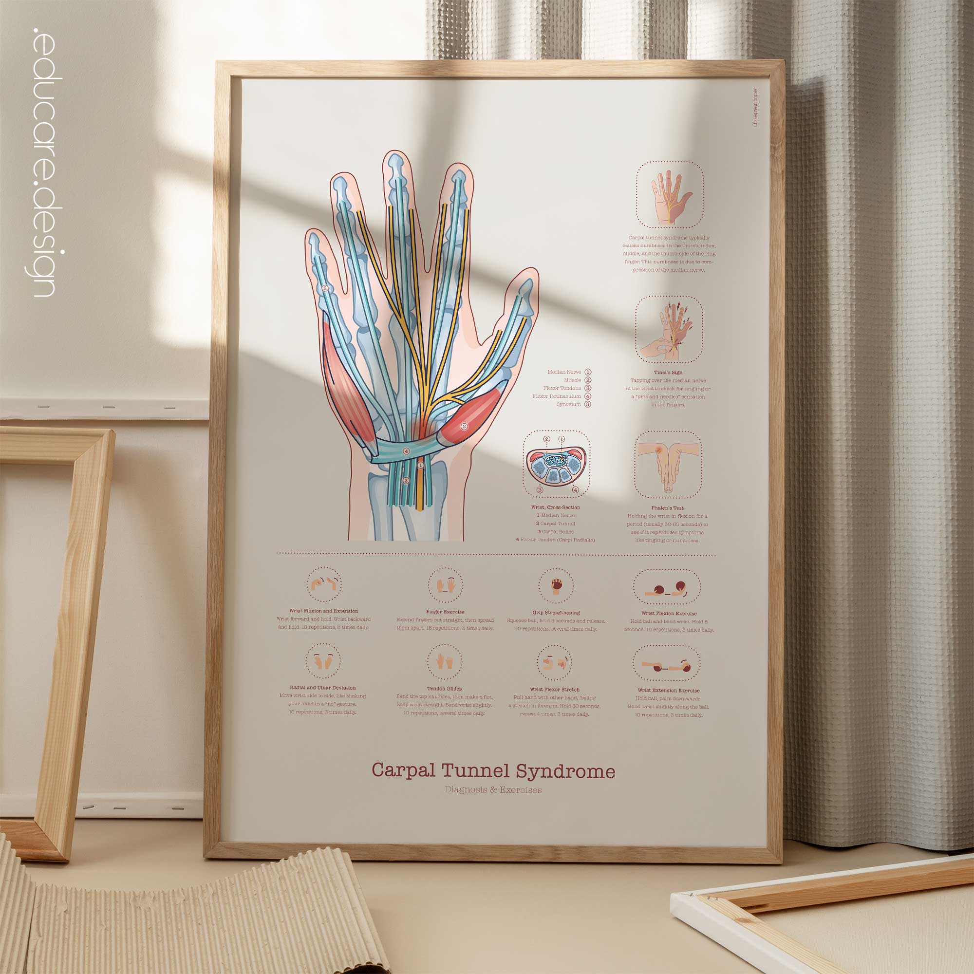 Syndrome du Canal Carpien avec Diagnostic et Exercices