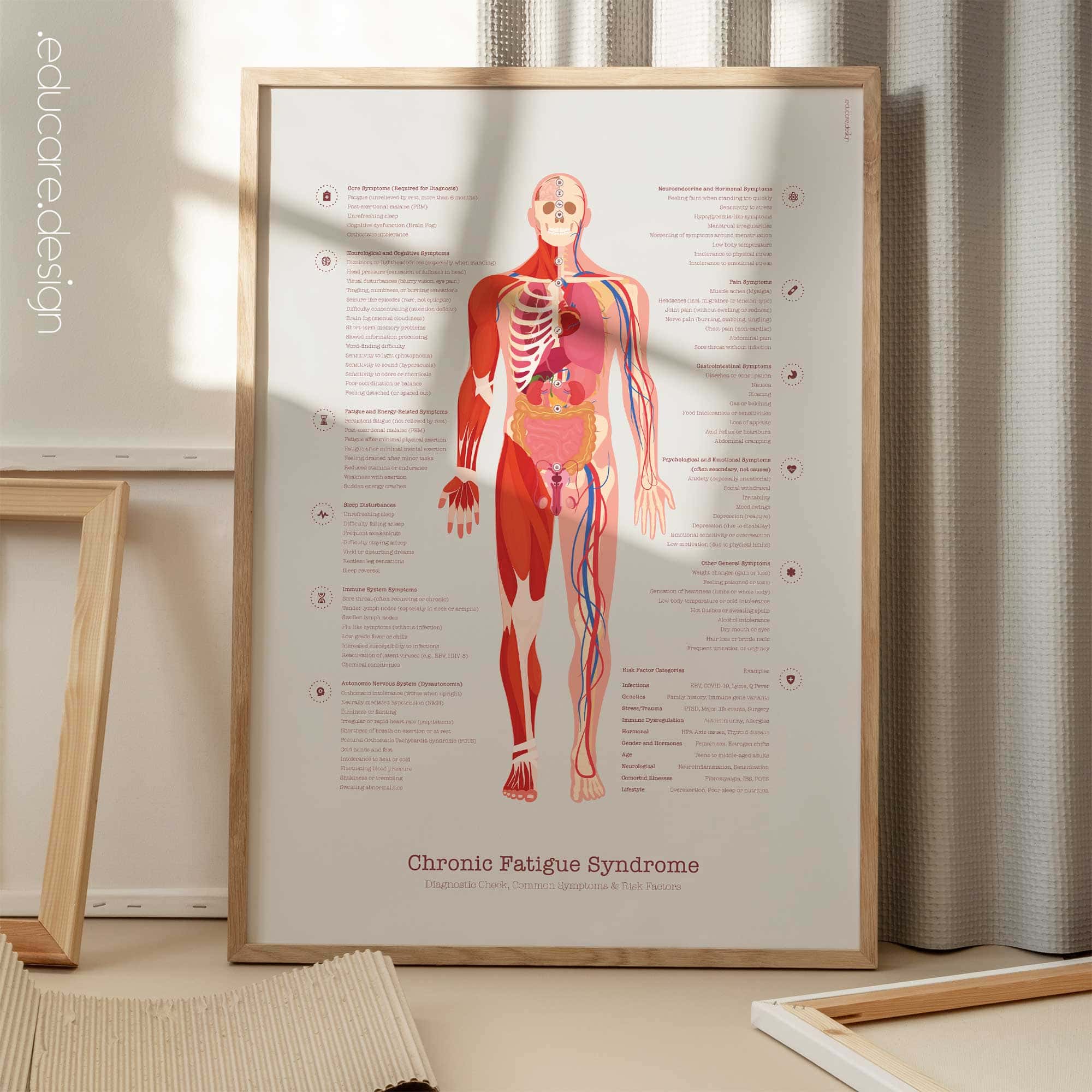 Chronic Fatigue Sindrome chart with Diagnostic Check, Common Symptoms & Risk Factors