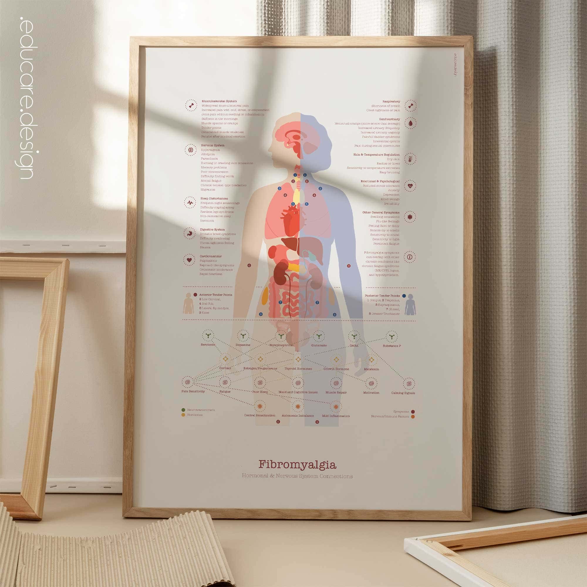 Fibromyalgie mit Hormonellen und das Nervensystem Systemverbindungen