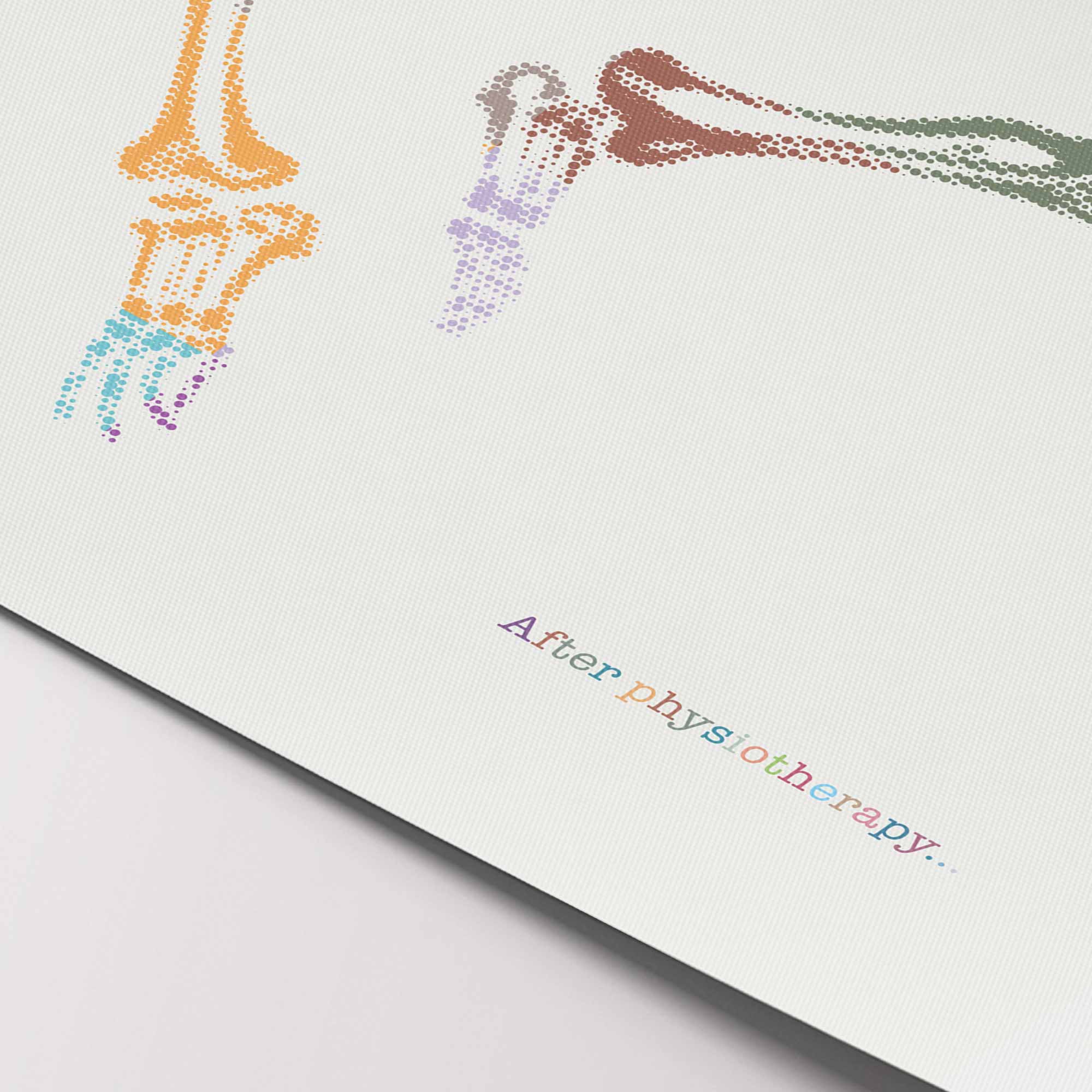 After Physiotherapy…