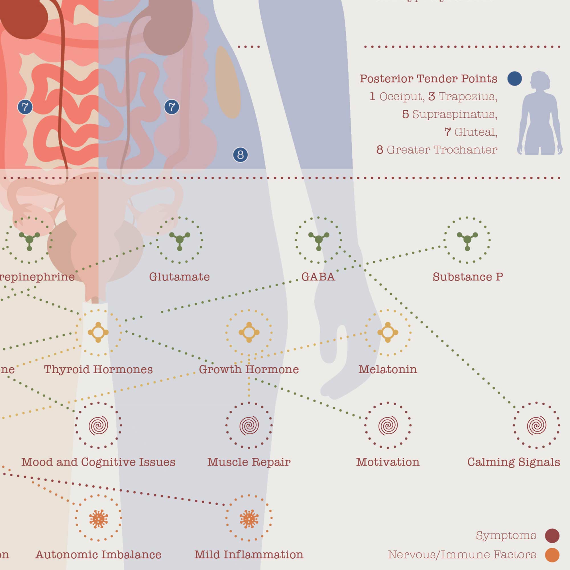 Fibromyalgia with Hormonal and Nervous System Connections