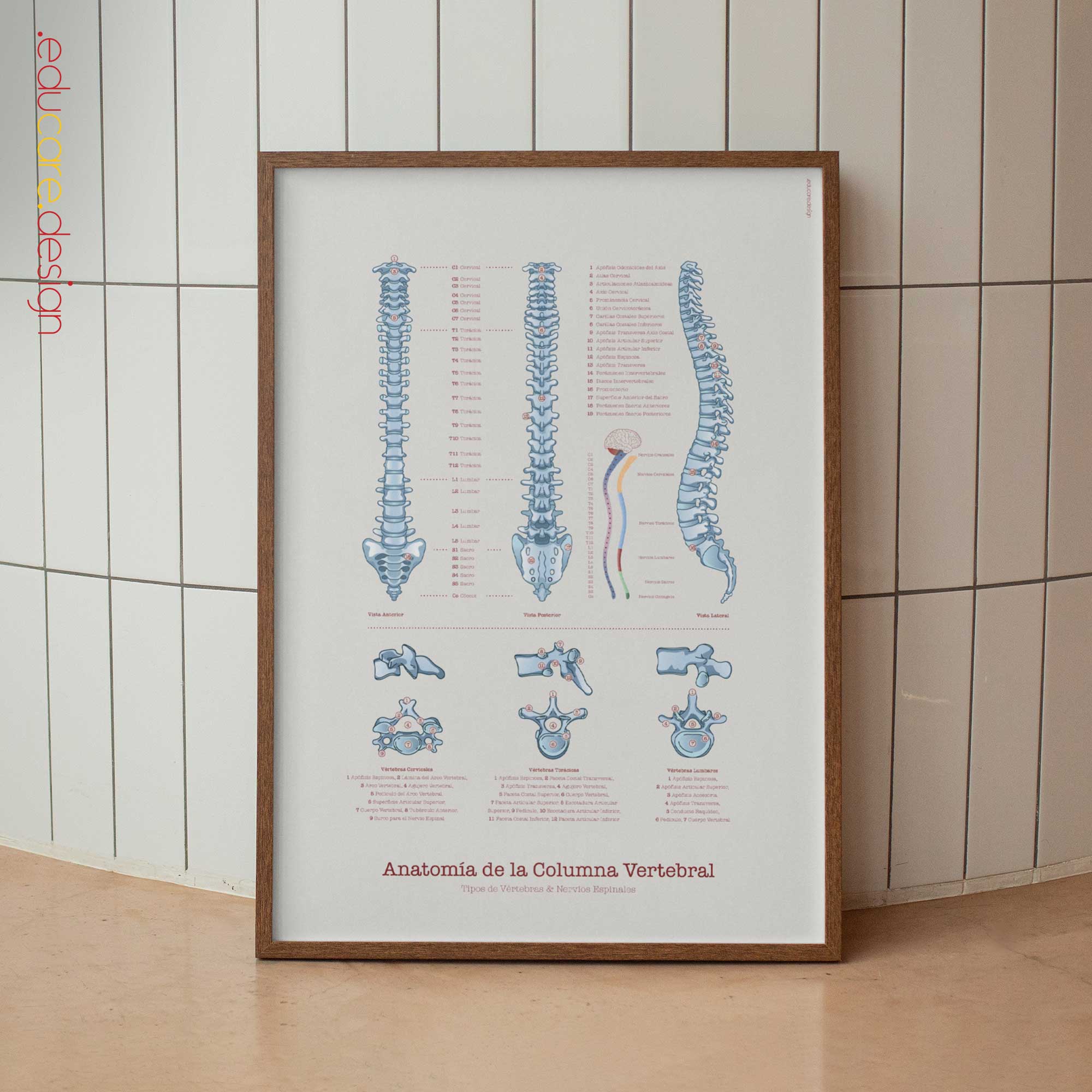 Anatomy of the Spine Chart, Black Edition