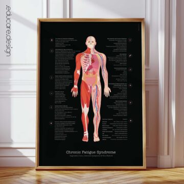 Chronic Fatigue Syndrome Anatomy Chart, Black Edition