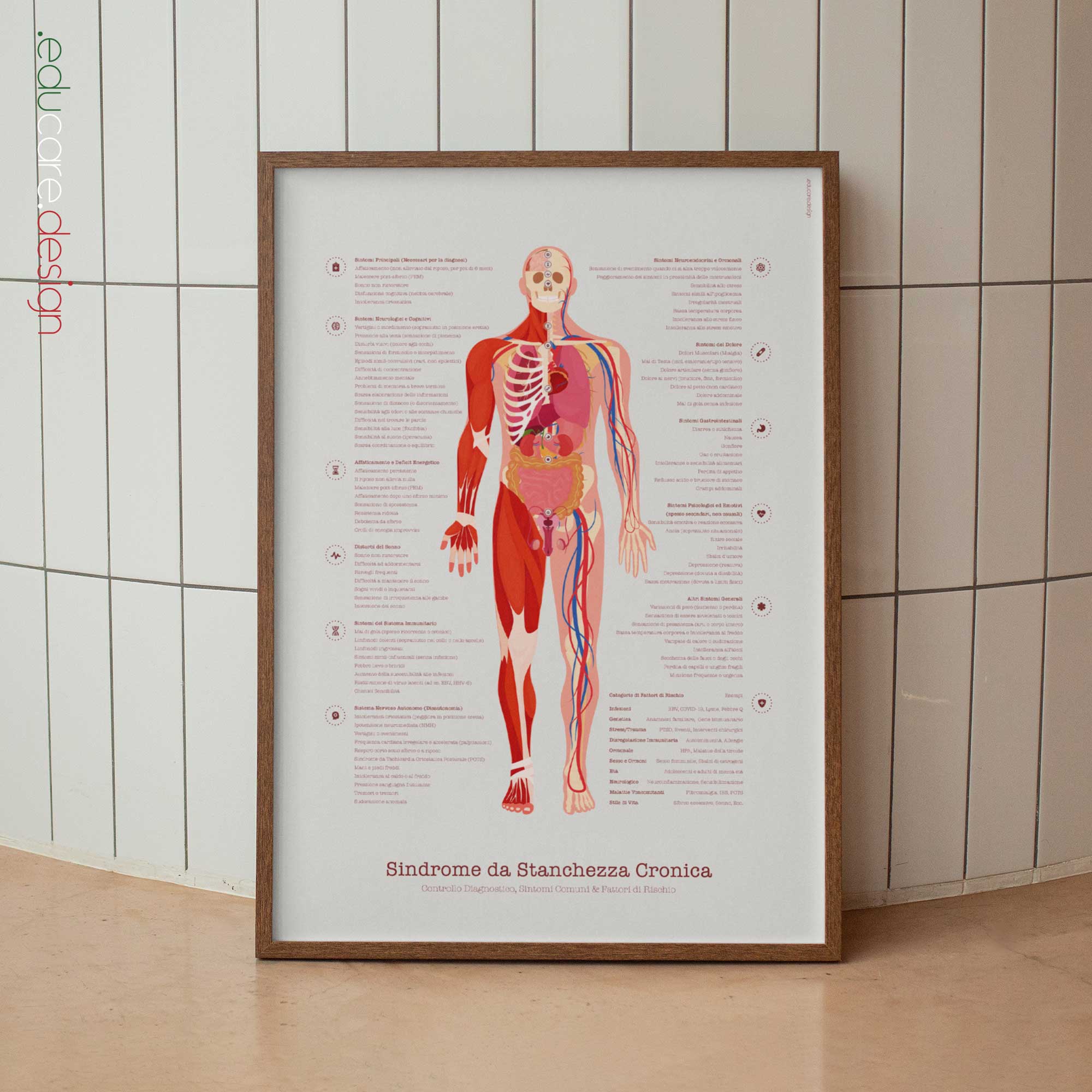 Chronic Fatigue Syndrome Anatomy Chart, Black Edition