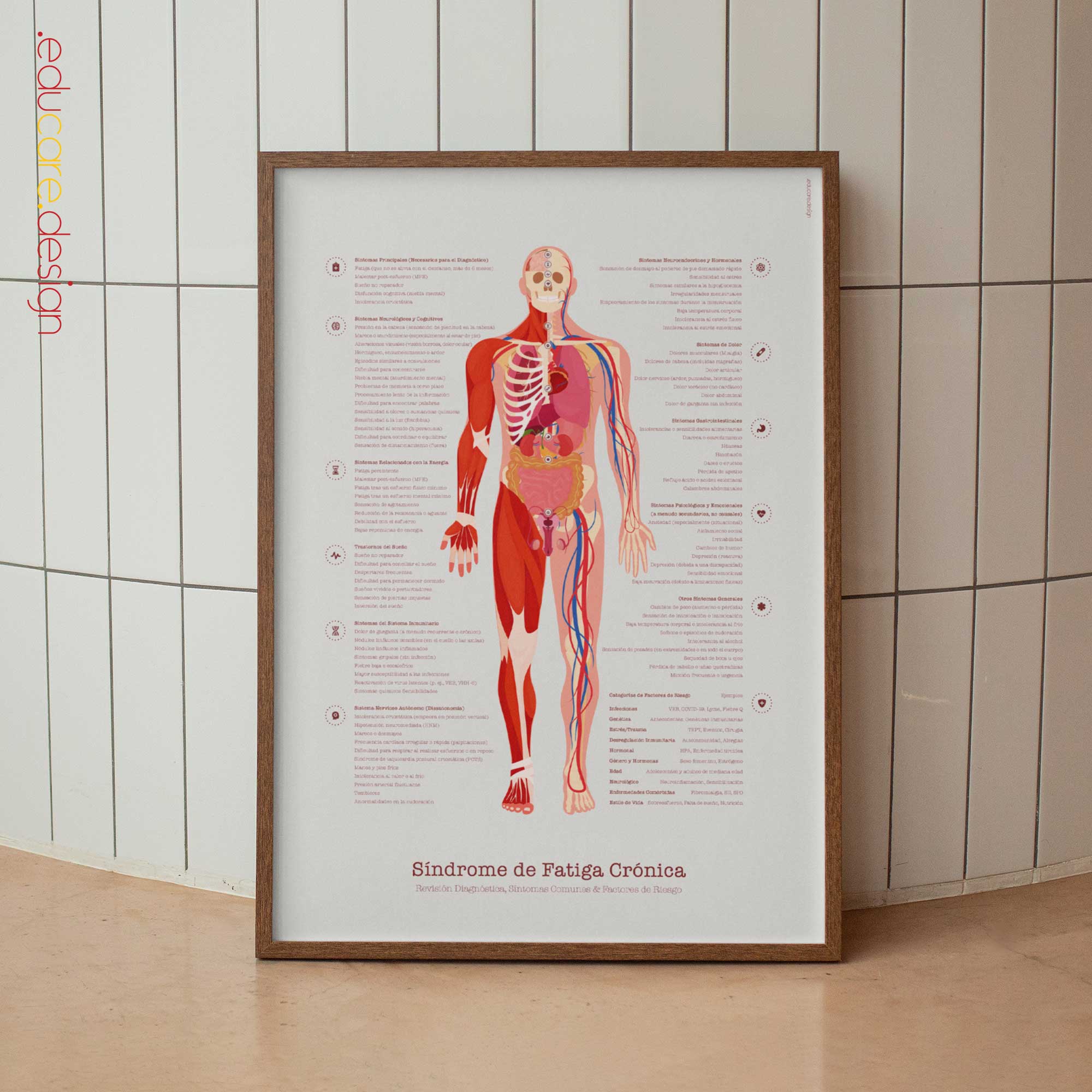 Chronic Fatigue Syndrome Anatomy Chart, Black Edition
