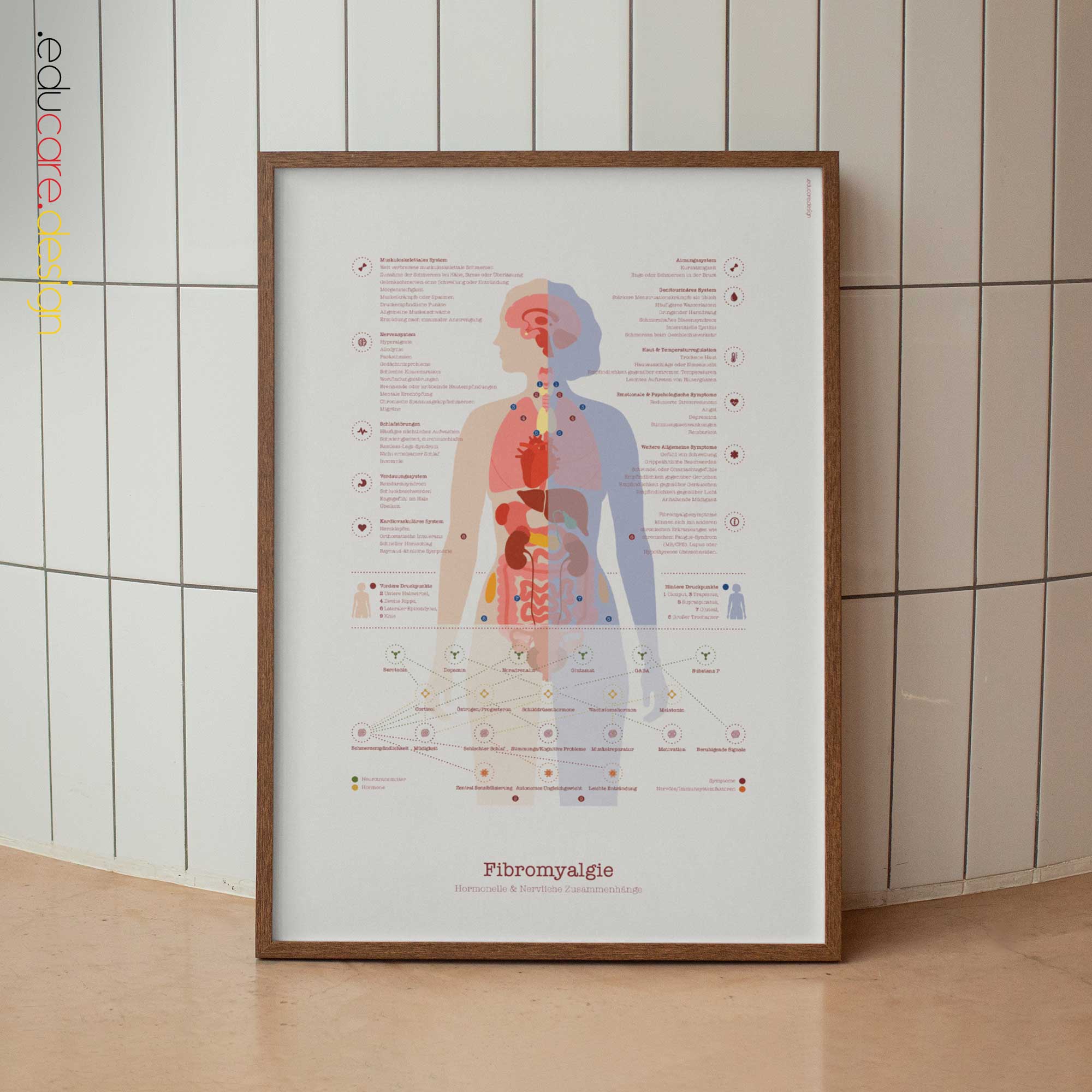 Fibromyalgia with Hormonal and Nervous System Connections