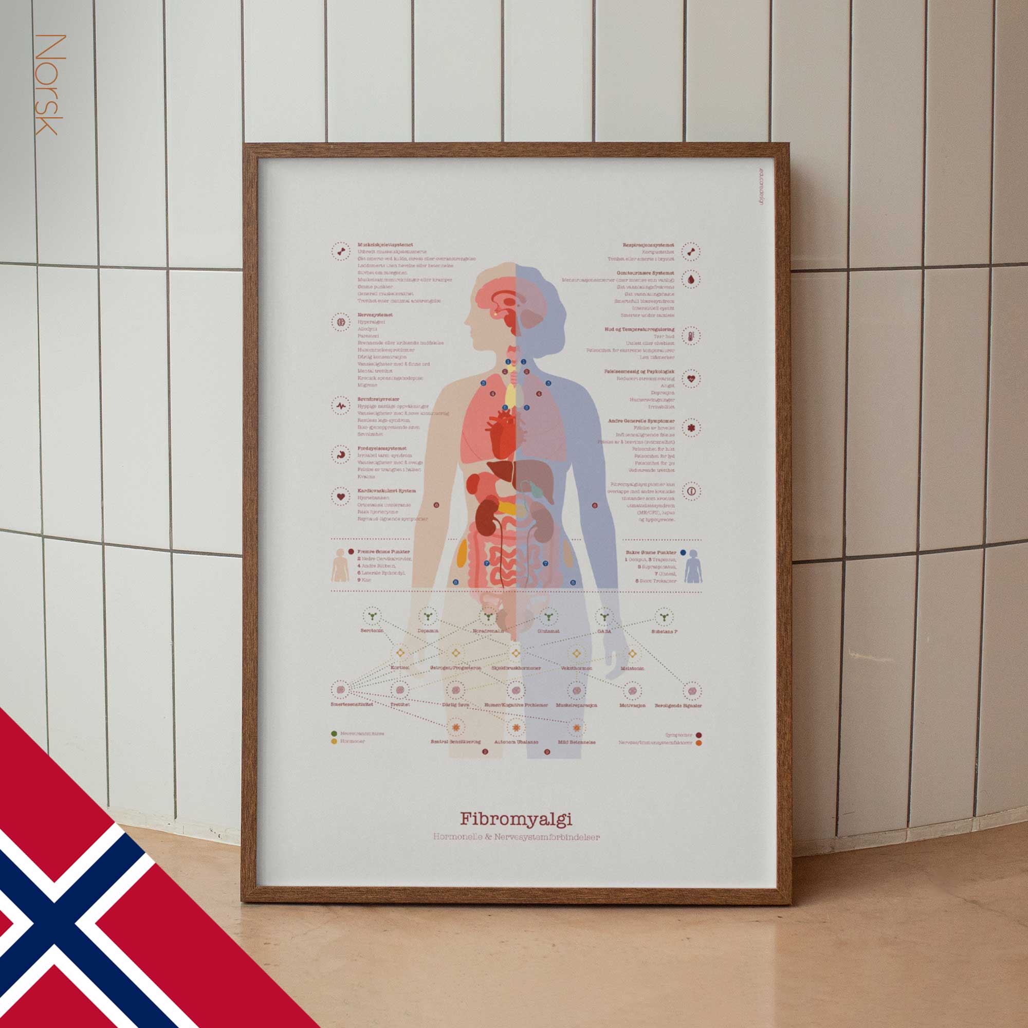 Fibromyalgia with Hormonal and Nervous System Connections