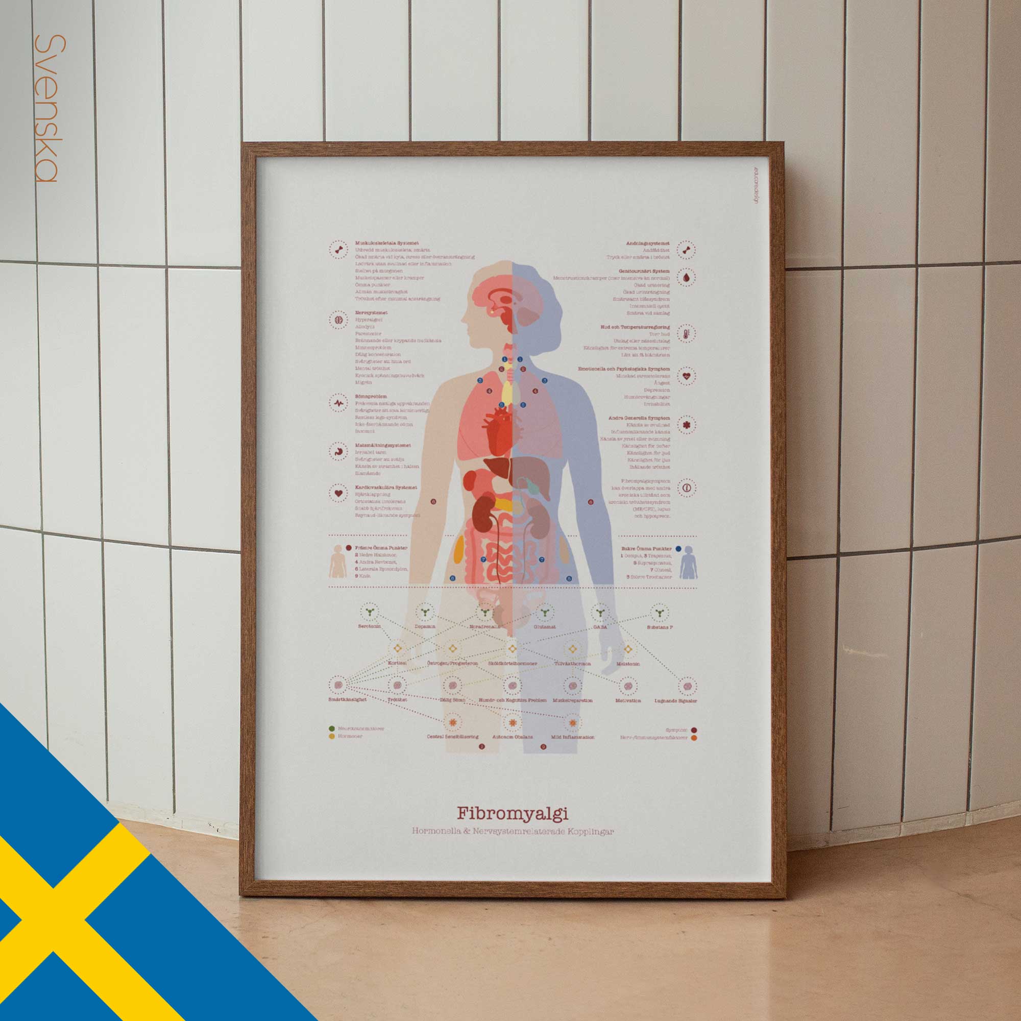 Fibromyalgia with Hormonal and Nervous System Connections