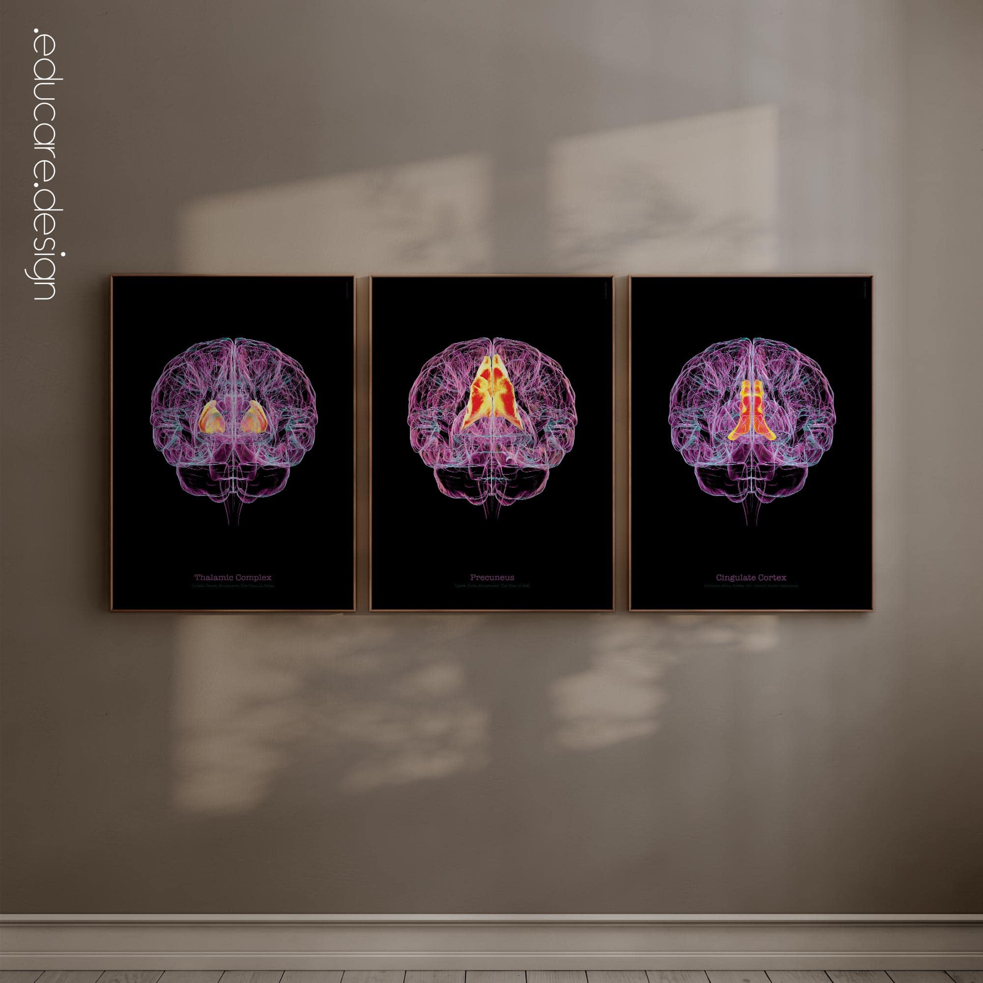 Cerebral Trilogy anatomy chart for clinics Cerebral Trilogy anatomy chart for clinics