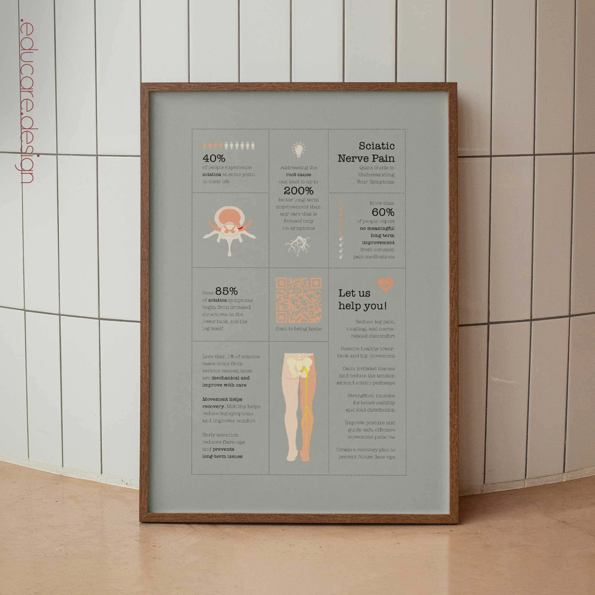 Sciatic Nerve Pain Quick Guide