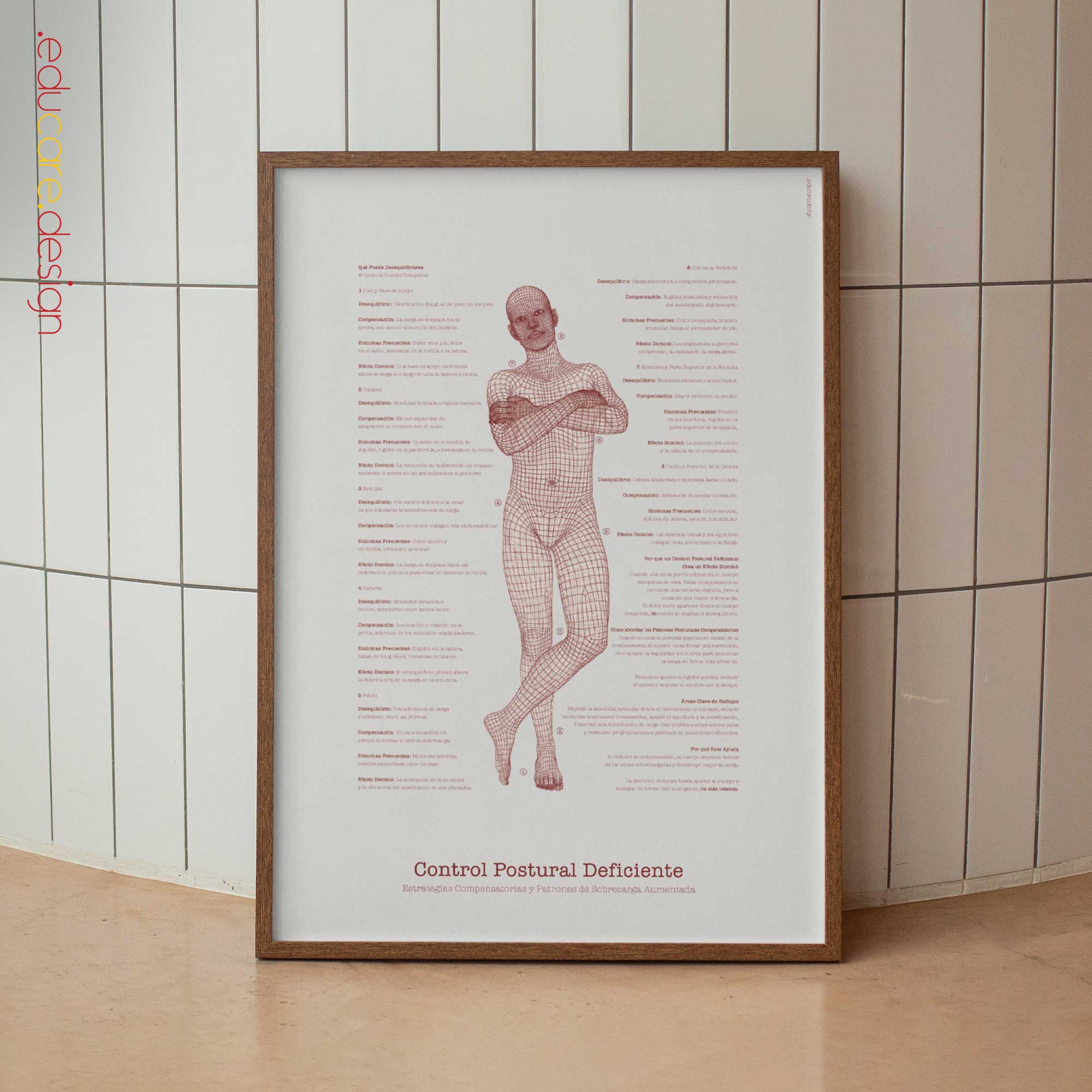 Poor Postural Control & Load Distribution | Posture Education Chart