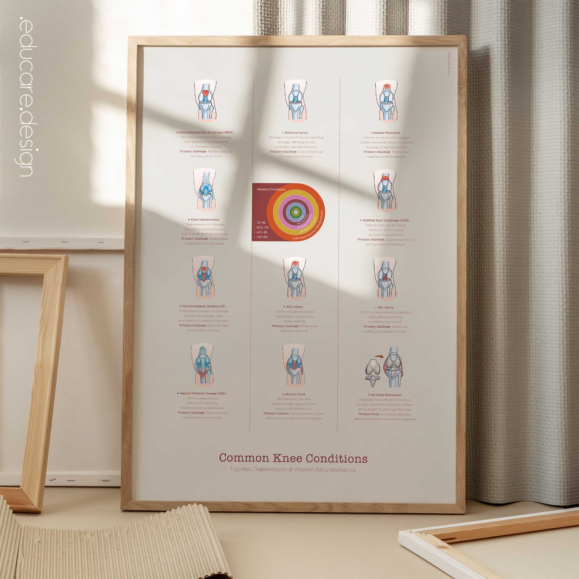 Common Knee Conditions
