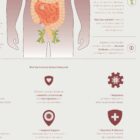 The Immune System anatomy chart for clinics