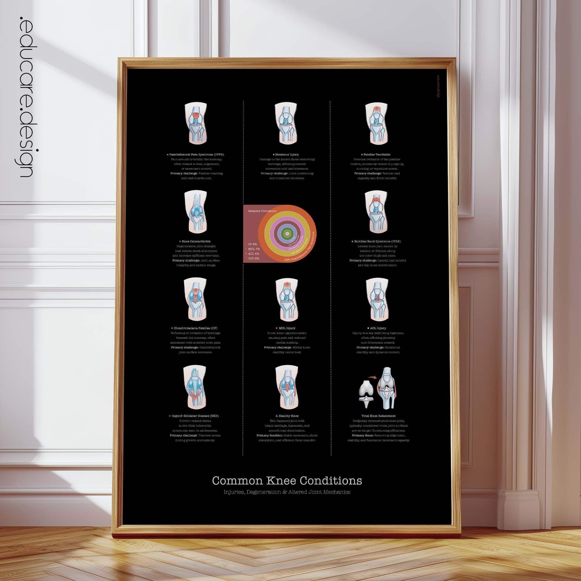Patient-friendly knee conditions chart illustrating common injuries, degeneration, and altered joint mechanics.
