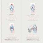 Common Knee Conditions anatomy chart for clinics
