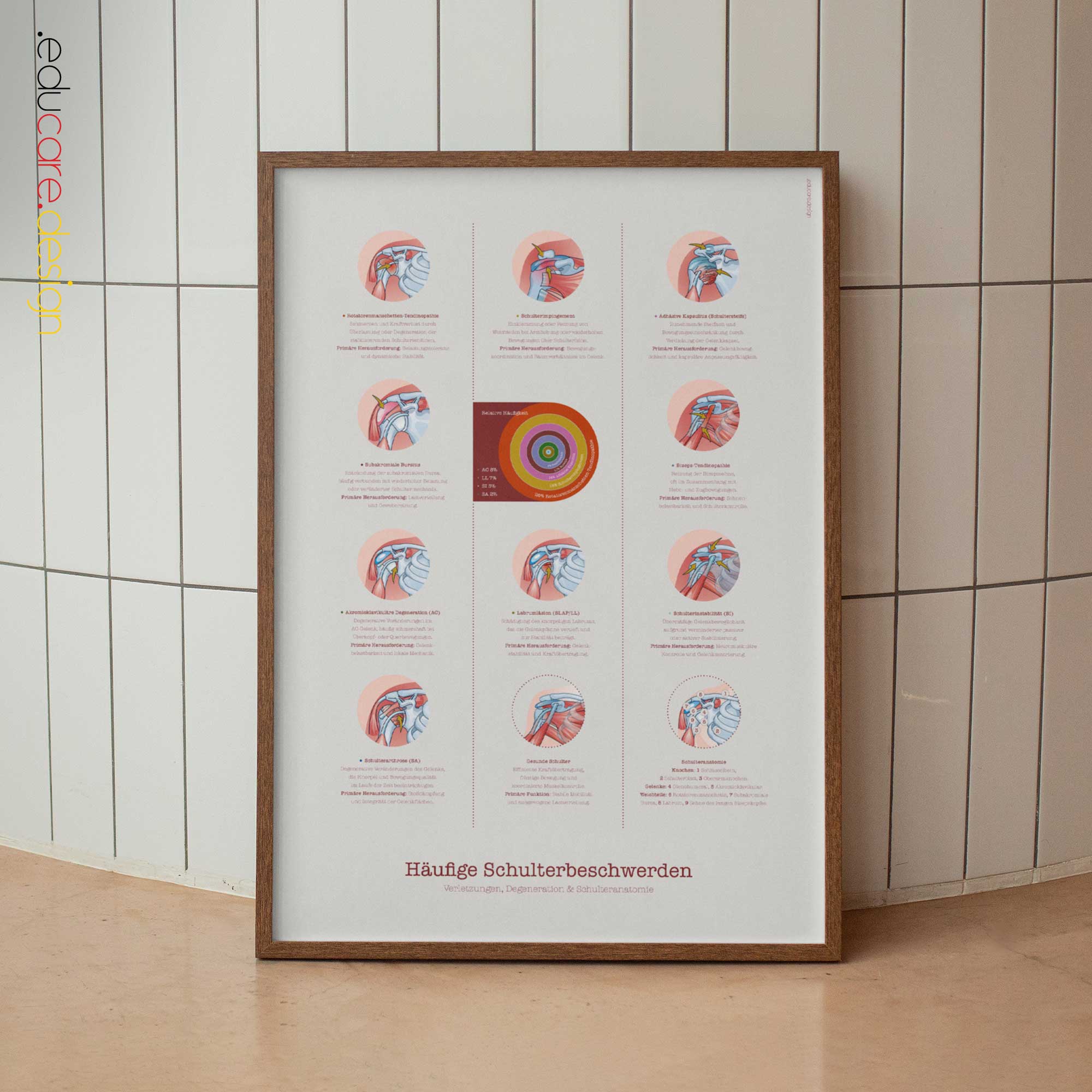 Common Shoulder Conditions Anatomy Chart