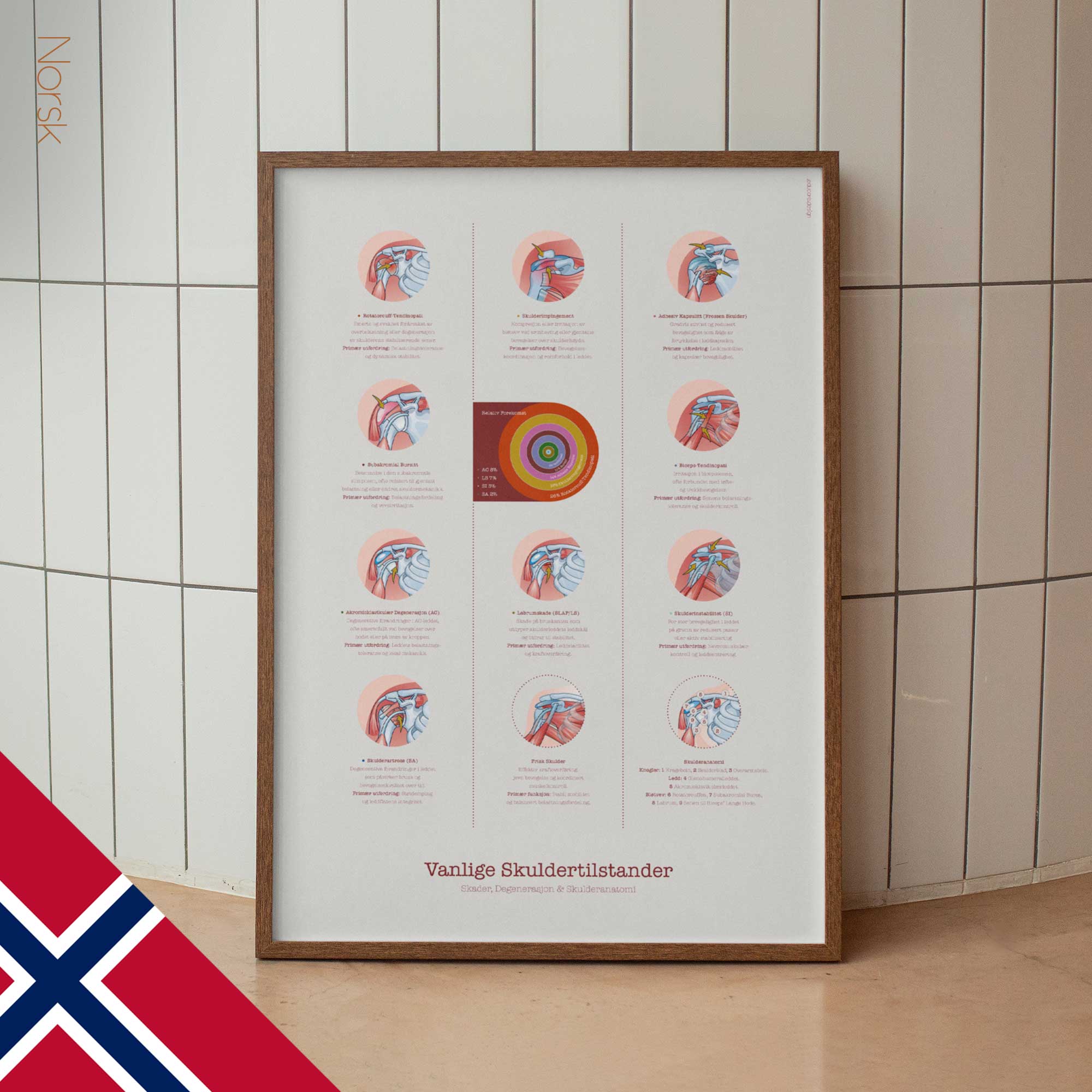 Common Shoulder Conditions