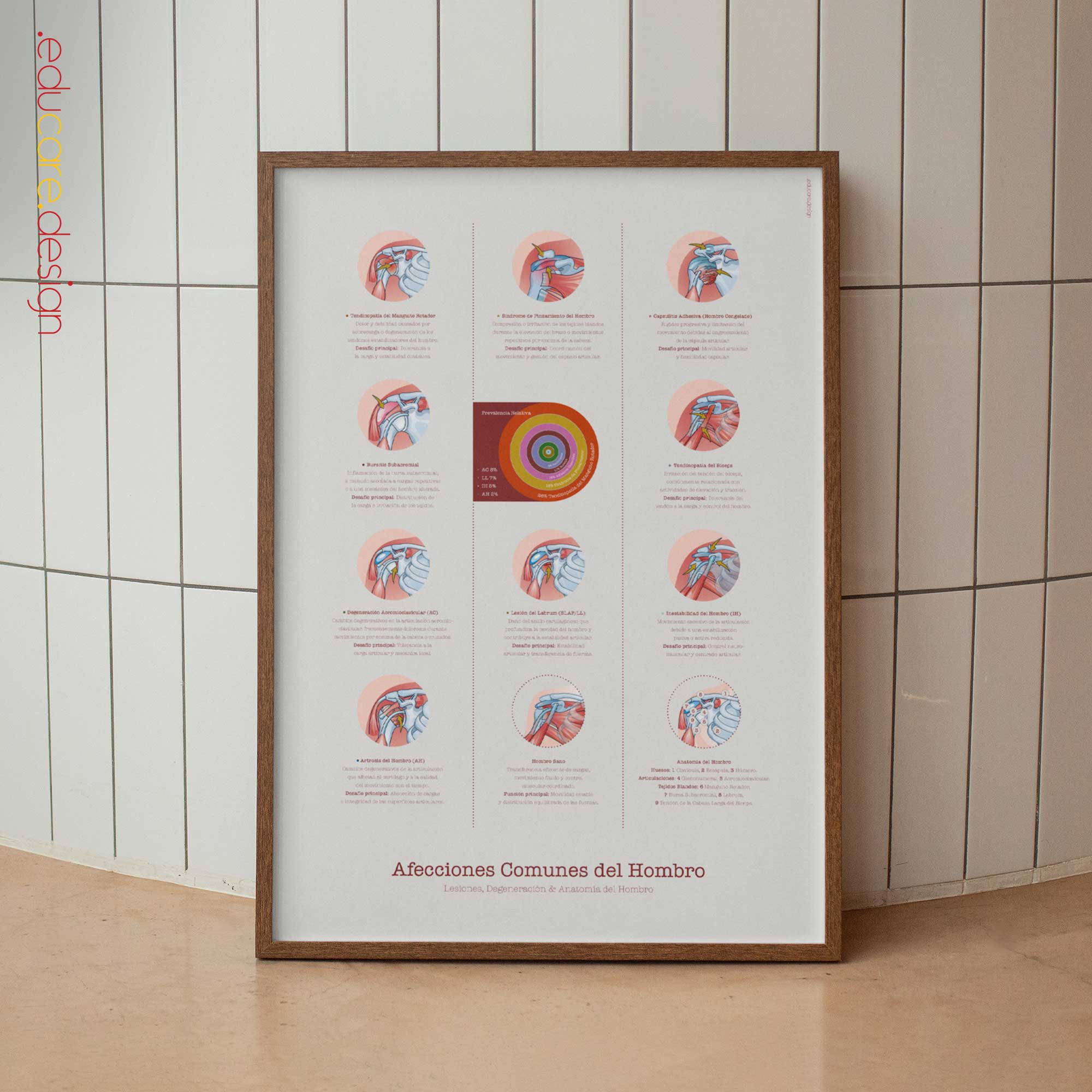 Common Shoulder Conditions Anatomy Chart