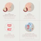 Malocclusion anatomy chart for clinics
