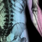 The Radiant Man anatomy chart for clinics