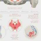 Pelvic Floor System anatomy chart for clinics